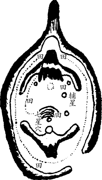 11.png
